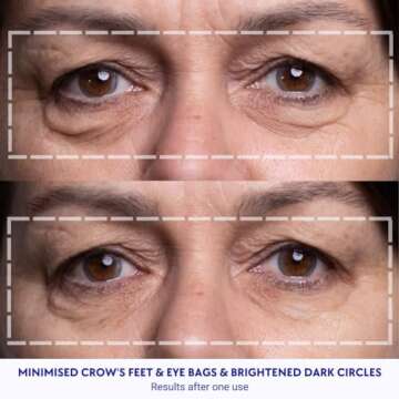 Wrinkles Schminkles Under Eye Patches | Smooth Eye Wrinkles Overnight
