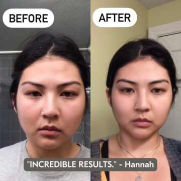 Mount Lai Stainless Steel Gua Sha Facial Tools, Facial Sculptor Skin Care Guasha Tool for Face and Body, Self Care Face Massager to Relieve Muscle Tension and Reduce Puffiness