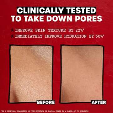 Thayers Alcohol-Free Rose Petal Witch Hazel Facial Toner for Glowing Skin, Soothing, Hydrating, Refreshing Toner for Normal and Combination Skin, 3oz