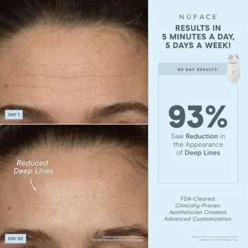 NuFACE TRINITY+ Microcurrent Device for Youthful Skin