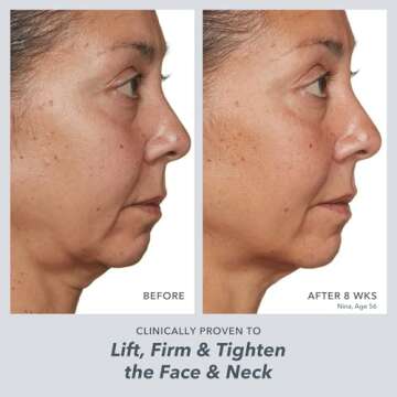 Beekman 1802 Milk RX Advanced Better Aging Face Cream - Goat Milk Protein Exosomes & Polypeptide Facial Moisturizer - Doctor Formulated for Collagen Boosting & Skin Firming - Fragrance Free