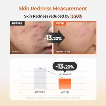 SKINFOOD Carrot Carotene Calming Water Pad 250g (8.81 oz.) 60 Sheets- Redness Relief Soothing Facial Toner Pads for Sensitive Skin, Cruelty Free, Valentine Day Gift