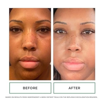 Replenix Anti-Aging Tinted Eye Cream Hydrates Brightens