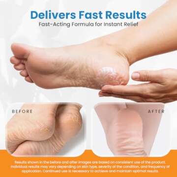 activelife - Revitaderm 4D Urea Cream 40 Percent for Feet Maximum Strength, for Dry Hands, Elbows and Knees, Callus Remover for Feet, Free Pumice Stone, 4oz, 1 Pack