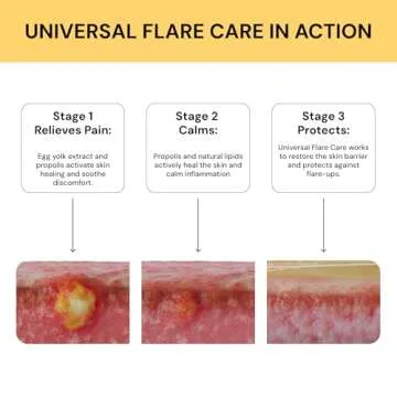 Universal Flare Care | Relief for 97% of Skin Issues | Cysts, Inflamed Skin, Hidradenitis Suppurativa, Abscesses, Impetigo | All Natural Flare Up Solution With Propolis & Egg Yolk Extract 4 oz
