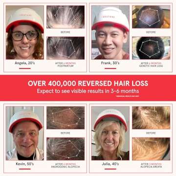 iRestore Professional + Rechargeable Battery Pack - Laser Red Light Therapy for Hair Growth - FDA Cl...