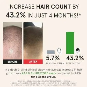 iRestore Pro Laser Hair Growth System | 282 Lasers & LEDs