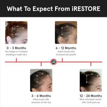 iRestore Pro Laser Hair Growth System | 282 Lasers & LEDs