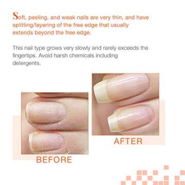 Nail Tek Intensive Therapy 2 Nail Strengthener - 0.5 oz Value Pack