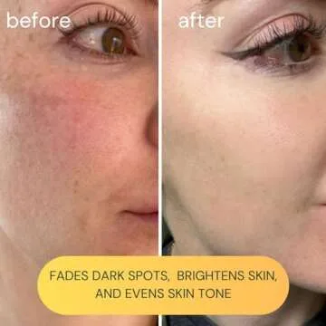 KOA LIFE Facial Oil and Vitamin C Serum for Hydration