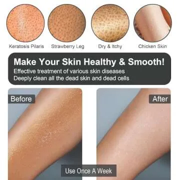 Yiclick 6Pairs Heavy Exfoliating Gloves,Body Scrub Exfoliator for Dead Skin Remover,Exfoliating Body Scrubber for Bath Shower Exfoliation,Exfoliate Sponge Loofah Washcloth Mitt Men Women