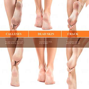 Updated 2024 Nano Foot Scrubber Callus Remover, Foot Care Pedicure Tool, fotwen Foot File with Nano-Level Grinding Points, Great for Dead Skin Removal, Cracking, Wet and Dry Feet…