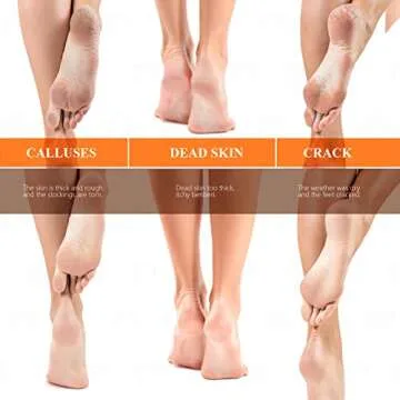 Updated 2024 Nano Foot Scrubber Callus Remover, Foot Care Pedicure Tool, fotwen Foot File with Nano-Level Grinding Points, Great for Dead Skin Removal, Cracking, Wet and Dry Feet…