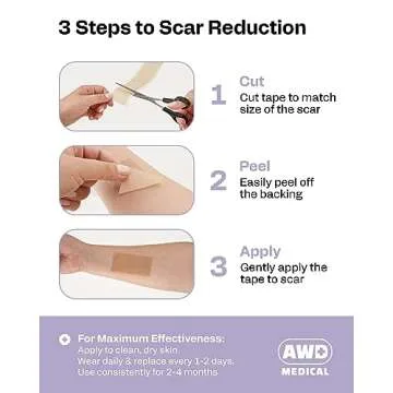 AWD Silicone Scar Sheets for Surgical Scars - Medical Grade Silicone Scar Tape for C Section, Tummy Tuck Tape, Keloid Treatment - Silicone Skin Patches After Surgery Must Haves (1.6" x 60" Roll)