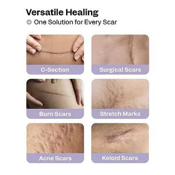 AWD Silicone Scar Sheets for Surgical Scars - Medical Grade Silicone Scar Tape for C Section, Tummy Tuck Tape, Keloid Treatment - Silicone Skin Patches After Surgery Must Haves (1.6" x 60" Roll)