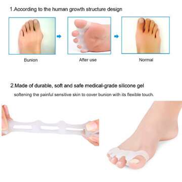 1 Pair Gel Toe Separator Toe Stretcher - RAGZAN Hammer Toe & Bunion Corrector for Men and Women, Correct Your Toes Naturally - White