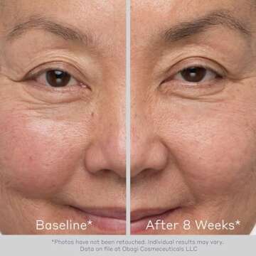 Obagi Nu-Cil Eyelash Enhancing Serum & Eyebrow Boosting Serum Set – Clinically Proven Formulas for Thicker & More Defined Looking Lashes & Fuller Looking Eyebrows