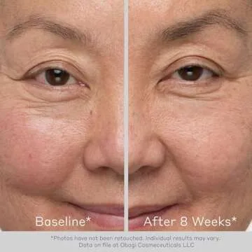 Obagi Nu-Cil Eyelash Enhancing Serum & Eyebrow Boosting Serum Set – Clinically Proven Formulas for Thicker & More Defined Looking Lashes & Fuller Looking Eyebrows