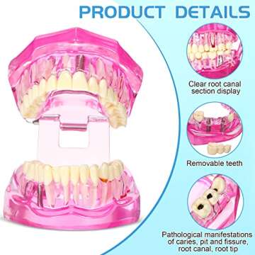 Outus Dental Implant Teeth Model for Education and Research