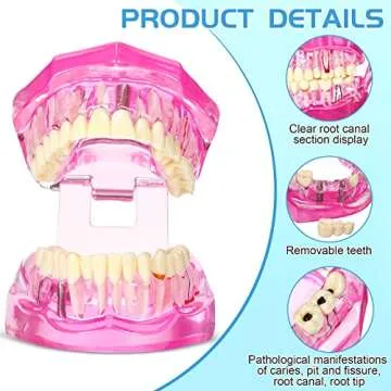 Outus Dental Implant Teeth Model for Education and Research
