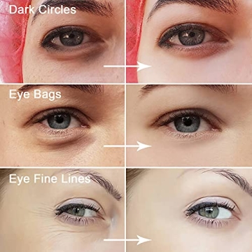 Permotary Collagen Eye Masks - 30 Pairs, Moisturizing & Anti-Aging