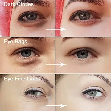 Permotary Collagen Eye Masks - 30 Pairs, Moisturizing & Anti-Aging