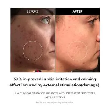 APRILSKIN Carrotene Clarifying Facial Serum | Vegan, Non-comedogenic | Blemish Clear, Dark Spot Corrector | Korea Skincare | Oily Skin, Sensitive Skin, Bumpy Skin | 1.25 fl.oz