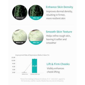 REJURAN® Turnover Ampoule, c-PDRN® - Anti-Aging Face Serum for Firmness, Radiance, and Youthful Skin. Korean Skin Care, Clinically Developed (1.01 fl oz)