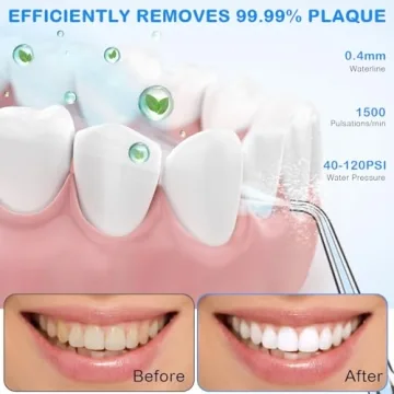 Portable KOOVON Water Flosser with Travel Case and Jet Tips