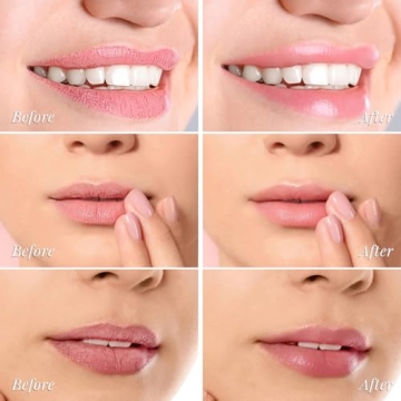 ANRCOLLECT Lip Mask Set 3 Overnight Masks + Lip Scrub