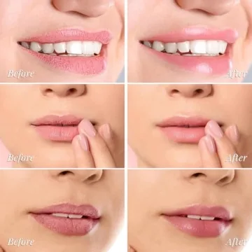 ANRCOLLECT Lip Mask Set 3 Overnight Masks + Lip Scrub