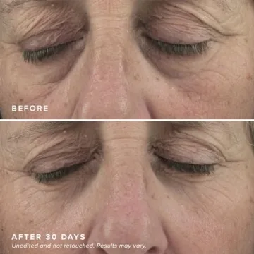 DRMTLGY Brightening Eye Masks for Dark Circles & Puffiness