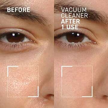 Dr. Brandt Skincare Pores No More Vacuum Cleaner Purifying Mask, 1 Oz