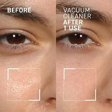 Dr. Brandt Skincare Pores No More Vacuum Cleaner Purifying Mask, 1 Oz