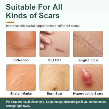 FUNNIR Silicone Scar Sheets,Tape, Strips - Healing Keloid, C-Section and Tummy Tuck - As Surgical Cr...