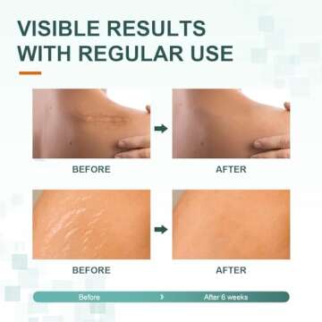 FUNNIR Silicone Scar Sheets,Tape, Strips - Healing Keloid, C-Section and Tummy Tuck - As Surgical Cream, Gel, Patch, Bandage, Pad - Surgery Scars Treatment 5.7"x1.57" - 6 Pack