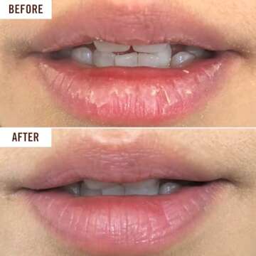 Hanalei Cruelty-Free Treatment for Chapped Lips, Extreme Dry Lip Moisturizer, Overnight Lip Balm for Cracked Lips, Made with Kukui Oil, Shea Butter, Grapeseed Oil, Clear Formula, Full Size (15 g)