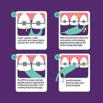 Platypus Braces Flossers, 40 Count for Easy Dental Care