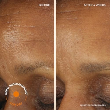 RoC Deep Wrinkle Moisturizer Bundle - Night & Day