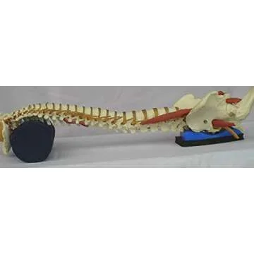Sacro Wedgy Male Complete System for Back Pain Relief