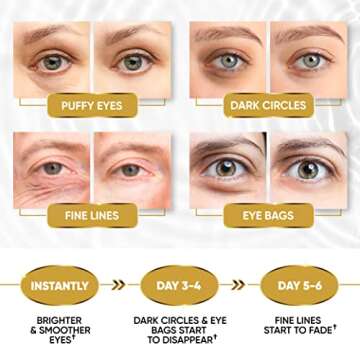 Gold Under Eye Mask for Puffy Eyes, Dark Circles, Eye Bags, Puffiness, Wrinkles - Hydrating Under Eye Patches with Collagen, Hyaluronic Acid Skincare - Anti-Aging Eye Patch Treatment Masks