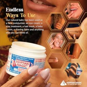 Egyptian Magic - All Purpose Face, Body, and Dry Skin Moisturizing Cream, Skin Protectant for Women & Men, Eczema Care Healing Balm, Scar Treatment, Stretch Marks, and Tattoo Aftercare, 2oz Jar