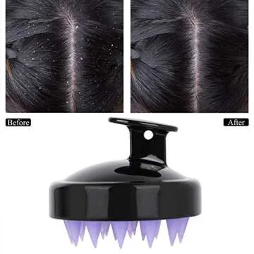 Hair Scalp Massager Wet Head Brush Shampoo Dry Scalp Care Brush with Soft Silicone Head Dandruff Brush Pack of 2