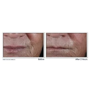 Best RoC Retinol Anti-Aging Patches for Fine Lines