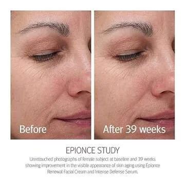 Epionce Renewal Facial Cream - Hydrating, Anti-Aging Moisturizer for Dry & Sensitive to Normal Skin, For Fine Lines & Wrinkles, Dermatologist Skincare