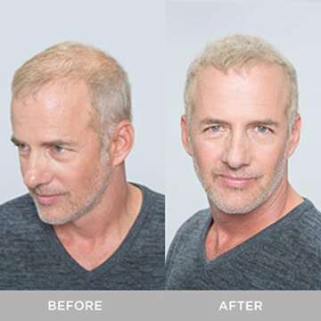 XFusion Keratin Hair Fibers - Medium Brown (3g Travel Size)