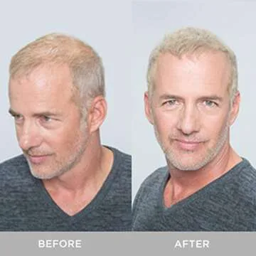 XFusion Keratin Hair Fibers - Medium Brown (3g Travel Size)