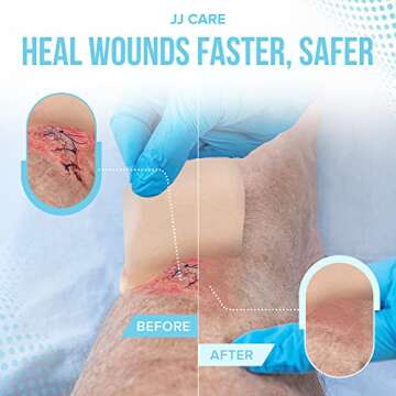 JJ CARE Hydrocolloid Dressing 2x2 [Pack 10], 0.8MM Thick Hydrocolloid Bandages with Border, Self-Adh...