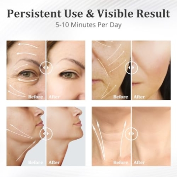 Anti-Wrinkle Facial Massager with 3 LED Modes