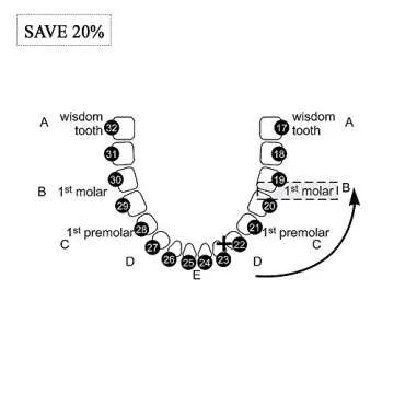 Tongue-Tied: Functional Assessment and Remediation of TOTs (Tethered Oral Tissues)